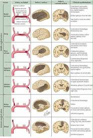 Vessel Blockage Outcome Medical Anatomy Medical Studies Medical Knowledge