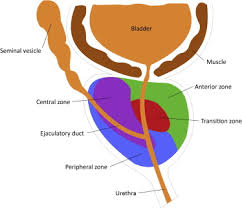 Image result for Expressed Prostatic Secretion