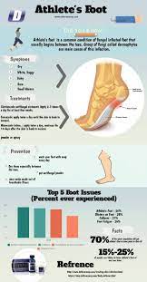 7 Common Habits You Might Not Know Can Lead To Athlete S Foot