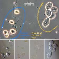 Tubular Epithelial Superficial Urothelial Cells Phase Contrast Pseudo Dic And Bright Field Original Magnification X4 Cell Medical Laboratory Science Tubular