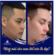 NÂNG MŨI NAM NHƯ THẾ NÀO LÀ ĐẸP?