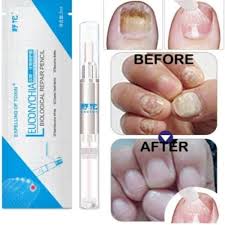Maybe you would like to learn more about one of these? Jual Obat Jamur Kuku Kab Sleman Syadiyah4 Tokopedia