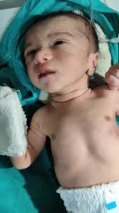 Boby sey is normal dilevry for 7month. #viralreels #NICUCare #baby  #cutebaby #newbornbaby #babycrying #cutebabies #welcomebaby #viral  #viralpost Gautam Sachin Beenu Bharti Tinku Rawat Rawat