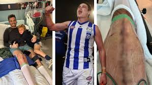 Former AFL player's minor surgery leads to near-death nightmare - Herald Sun