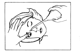 Image result for Eye Irrigation