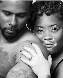 Meet Paul, Peter, and Tyrone 🥰🥰 Nigerian-born brothers sharing their  journey with vitiligo and spreading awareness with courage and confidence.  Their story reminds us that beauty comes in all shades, and confidence