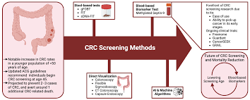 Image result for Colon Cancer Screening with Colonoscopy