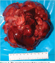 Feeling very full after a small meal. Pdf Liver Tumors In Cats And Dogs Semantic Scholar