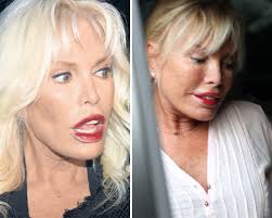 Ajda Pekkan In Son Hali Michael Jackson A Benzetildi