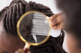 Garlic is a potent natural remedy that can be used for several ailments, including head lice. Can Black People Get Lice Symptoms Treatment And Prevention