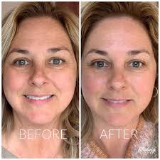 SOUL of skincare and wellness