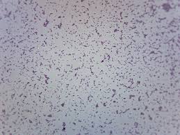 Image result for Schoenoplectiella microglumis