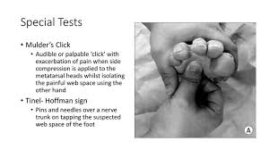 Pin On Fit Chicks Get Injured Or Sick Too