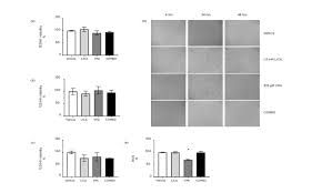 I would like to share my personal experience and answer any questions you may have. At Physiologically Relevant Concentrations Valproic Acid And Lithium Carbonate Reduce Oxidative Stress In Human Astrocytoma Cells European Medical Journal