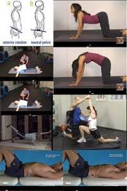 5 Simple Exercises For Correcting Anterior Pelvic Tilt Scoliosis Exercises Exercise Pelvic Tilt