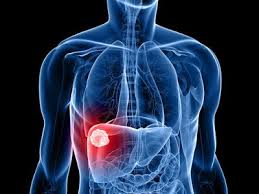 Pin En Remedios Para La Salud