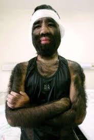 L'HOMME LE PLUS VELU