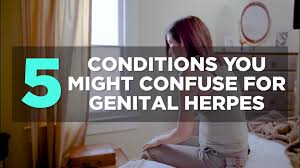 Since sexual contact is the primary mode of transmission. Herpes Simplex 1 Vs Herpes Simplex 2 Health Com