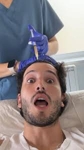 ¡Se hizo un injerto de pelo! 😳💇🏻‍♂️, Durante una entrevista para  @los40spain, el cantante colombiano @sebastianyatra confesó que se sometió  a un tratamiento capilar para compartir la calvicie ...