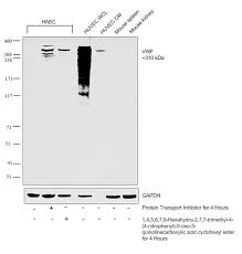 What is the difference between a variable wavelenght detector(vwd) and a diode array detector(dad)? Vwf Antibody Pa5 16634