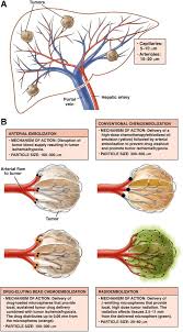 Pin On Hepato Pancreato Biliary