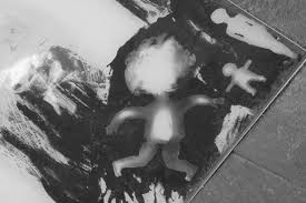 Bis zum ende des jahres 1945 starben daran mehr als 200.000 menschen. Das Fotogramm Hiroshima Windrose Rocks