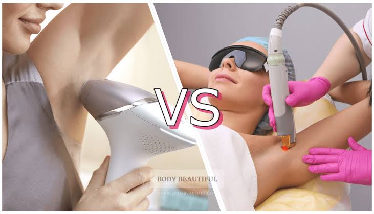 At-home vs professional laser hair removal comparison at Z's Studio