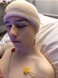 Sheffield teenager who had brain tumour removed last Christmas launches new  appeal