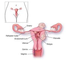Diagnosis and treatment of ein can prevent it from becoming. Endometrial Cancer Diagnosis And Treatment Niruja Healthtech