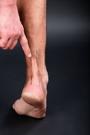 Foot Pain Have You Injured Your Achilles Tendon Orthopaedic Associates Of Central Maryland