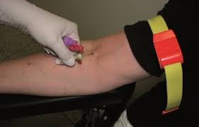 Praxisanleitung Blutabnahme Klinik Via Medici