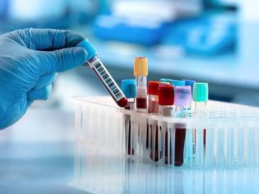 Diagnostic multiplex platforms streamline complex blood testing., AI generated