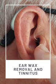 Ear Wax Can Cause Chronic Tinnitus How To Remove Ear Wax Ear Wax Ear Wax Removal Ear Candling