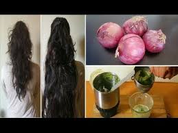 Onion Juice Curry Leaves Hair Mask To Regrow Hair From Roots Amp Get Long Thick Strong Hair Youtube Regrow Hair Hair Remedies For Growth Onion For Hair