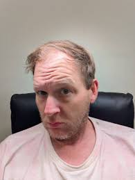 Delete if not allowed)