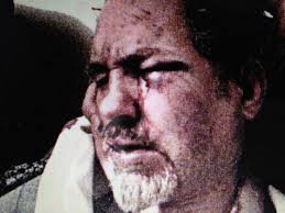 Builder sentenced for assault