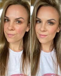 Being a woman 👩🏻 is so weird right? — My skin can look amazing one day  and the next it's random hormonal RED patches, a new brown spot, a blemish  here and