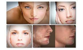 Vitiligo Treatment Amazon Com Appstore For Android
