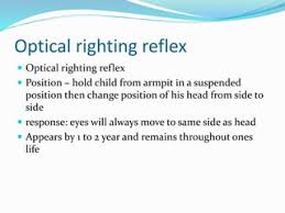 Ppt - Postural Reflexes Powerpoint Presentation, Free Download - Id:9574106