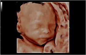 Rocky Fork Lake Events, Businesses And Discussions