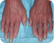 Image result for Pseudoeriosema