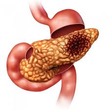 Your pancreas releases enzymes that aid digestion and produces hormones that help manage your blood sugar. Celebrity Case Reports Part 3 Steve Jobs Could He Be Alive Today 123 Sonography