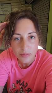 What Do Pincher Bug Bites Look Like