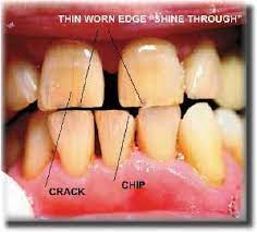Affordable Top Quality Dentists And A Holiday Sound To Good To Be True We Offer The Best Prices And Services For A Cheap Dental Care Dental Facts Dental Care