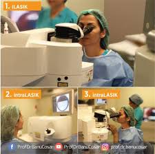 Lasik Tedavisinden Sonra Gozde Derece Kalmasi 100 Gozden 5 Inde Rastlanan Bir Durumdur Bu Durumda Ilk Islemden 6 Ay Sonra Ilave Lazer Tedav Rotus Serum Bilgi