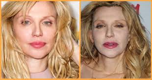 Learn about the ten most frequently performed cosmetic surgeries in the united states. 8 Hollywood Celebrities For Whom Plastic Surgery Turned Out To Be A Big Fail Genmice