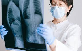 mesothelioma is most commonly treated with chemotherapy, although occasionally patients may also receive surgery and/or radiation therapy. Mesothelioma And Covid 19 Don T Skip Screening And Treatment