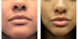 Rey N. Bello, MD, Physician