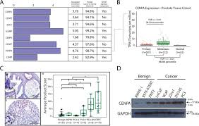 General guidelines all patients have a ct scan specifically for radiation therapy treatment. The Role Of The Histone H3 Variant Cenpa In Prostate Cancer Journal Of Biological Chemistry