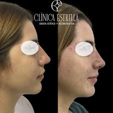 Photo by Dr. Nelson Estrella León (@dr.nelsonestrella) · September 18, 2024